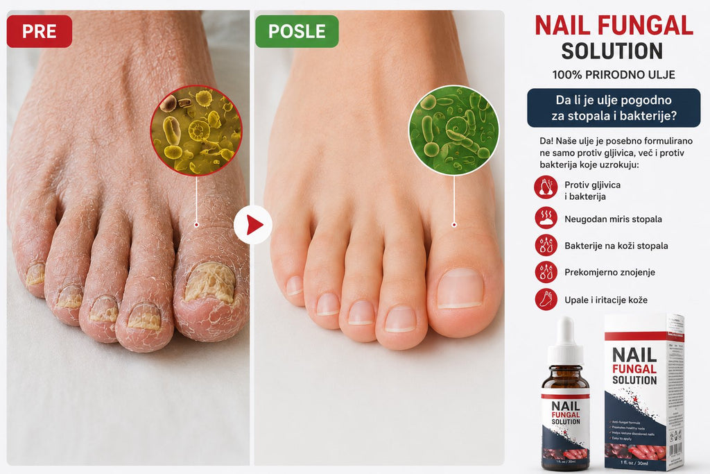 NAIL FUNGAL SOLUTION – Prirodna njega noktiju i stopala